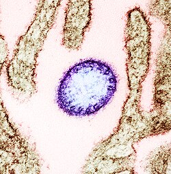 Nipa Virus